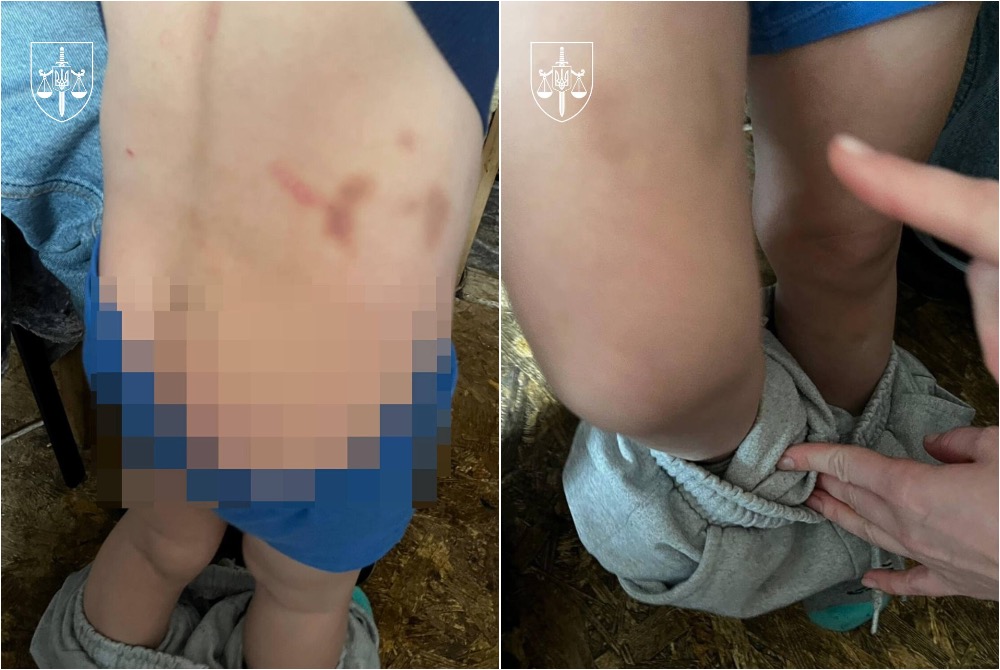 На Київщині чоловік катував двох маленьких дітей співмешканки