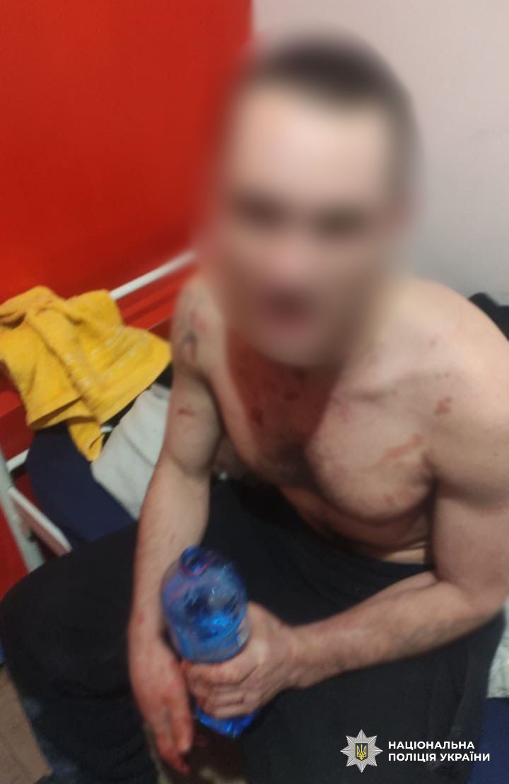 У Києві чоловік підірвав гранату у хостелі